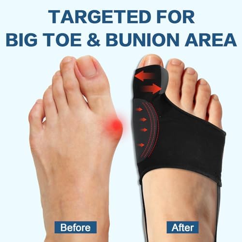 2Pcs Bunion Corrector for Women & Men, Comfortable Big Toe Straightener with Pads & Splint, Hallux Valgus Pain Relief for Day & Night Support with Anti-slip Strap(1 Pair, Black)