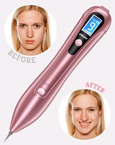 Wart and Skin Tag Remover Pen, Advanced at-Home Removal Kit Beauty Tool, Model CTS-15