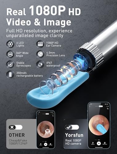 Ear Wax Removal, 3 in 1 Earwax Removal Kit, 1080P HD Ear Cleaner with Camera, FSA HSA Eligible, Otoscope with 7 Ear Spoon, Ear Cleaning 6 LED Lights 15 Ear Tips, Ear Camera for iOS & Android