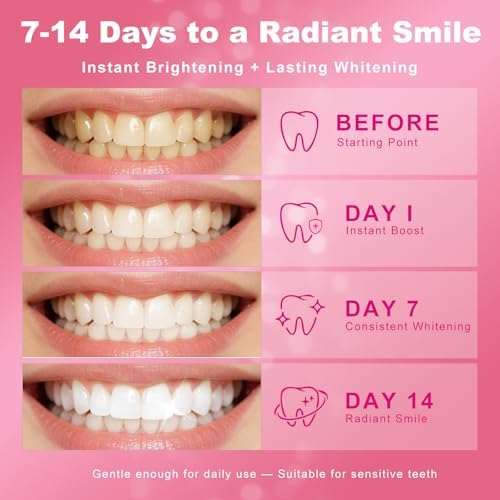 Teeth Whitening Kit with LED Light Tray for Sensitive Teeth, 5 Tooth Whitening Pen Gel Pain Free and Enamel Safe, Teeth Whitener at Home Up to 1-9 Shades Whiter in 1-2 Weeks