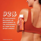 Bio-Oil Skincare Body Oil Serum, Face and Body Moisturizer with Vitamin E & A, for Scars, Stretch Marks, Sensitive Skin, All Skin Types, Dermatologist Recommended, Non-Comedogenic, 2 Oz