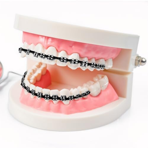 Temporary Clip on Teeth, Fake Braces Kit with Brackets & Wire, Suitable for Orthodontists to Explain and Practice for Dental Students - Brackets Falsos Para Dientes(Black)