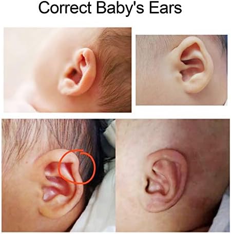 ZJchao Baby Auricle Valgus Correction Patch, Newborn Baby Ear Aesthetic Correctors Kids Infant Protruding Ear Patch Stickers, Children Ear Correction, Baby Silicone Gel Ear Tape 4cmx50cm