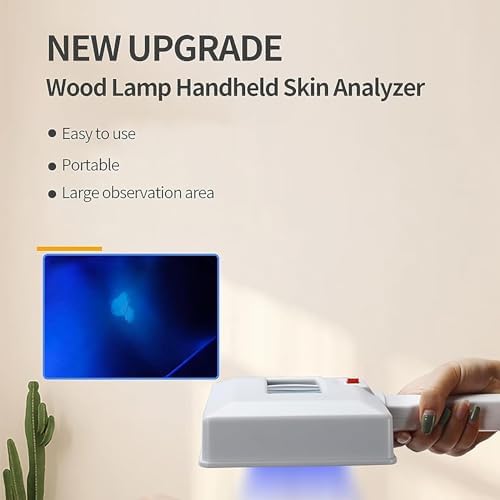 Woods Lamp Skin Analyzer, Skin Magnifying Analyzer Wood Light with Shading Cloth, Simple Operation and Clear Observation for Skin Analysis, for Skin, Analysis, Pet Testing