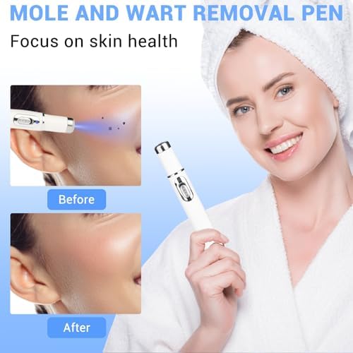 Maximum Strength WART Remover,Mole and Wart Removal Pen,Dark Spot Remover for Face and Body, Comfortable and Effevtive.