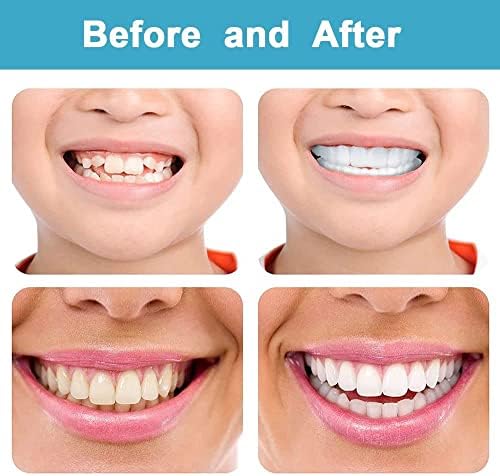 Denture Teeth Temporary Fake Teeth Snap On Top and Bottom for Men and Women, Fix Confident Smile