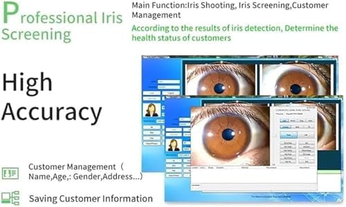 Iridology Camera Iris Analyzer USB 2.0 Interface Iriscope with 30x Iris Lens and Analysis Software Iridology Analysis Camera
