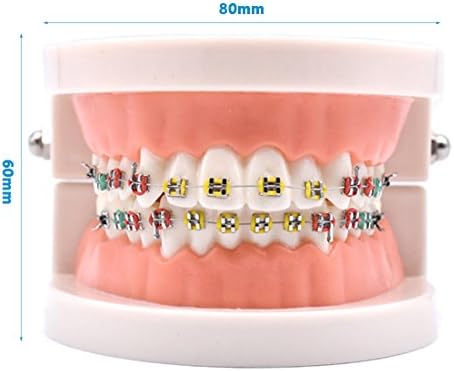 Angzhili 1 Piece Dental Demonstration Orthodontic Model with Metal Wires and Bracket (Metal Bracket)