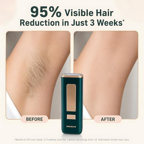 IPL Hair Removal for Women with Ice Cooling - 5 Energy Levels for Sensitive Skin - At-Home Laser Hair Removal for Face, Bikini, Legs, Underarms - Unlimited Flashes, Razor, Eyewear Included