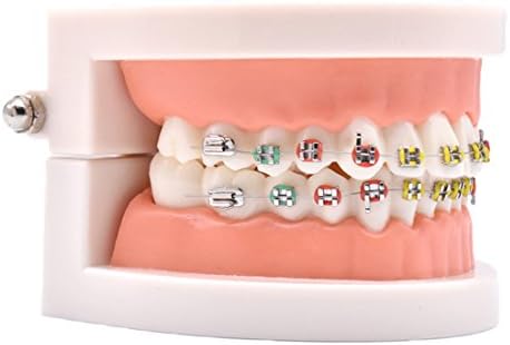 Angzhili 1 Piece Dental Demonstration Orthodontic Model with Metal Wires and Bracket (Metal Bracket)