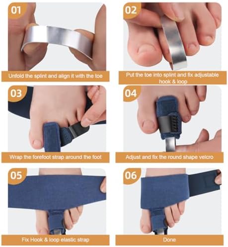 Toe Splints for Straightening Hammertoes Toe Brace Toe Straightener Toe Straps for Women Men Broken Toe Curled Toes Pain and Support 2Pcs
