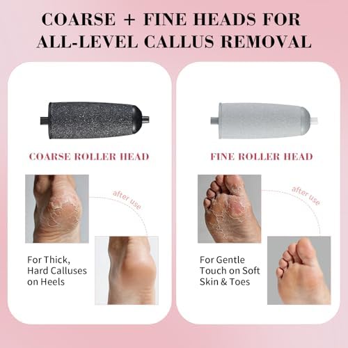 Electric Foot Callus Remover, Rechargeable Foot File Pedicure Kit for Hard Dry Cracked Skin, Professional At-Home Foot Care for Smooth Feet, Ideal Gift for Women and Men