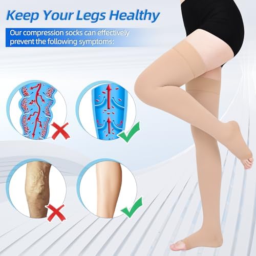 20-30mmHg Compression Stockings for Women, Open-Toe Thigh High Compression Socks, Medical Compression Stockings for Varicose Veins, Swelling, Teacher, Doctor