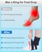 Adjustable AFO Brace for Drop Foot Relief - Medical Foot Drop Orthotic Support for Stroke Recovery, Plantar Fasciitis & Walking Stability - Breathable Lightweight (Men/Women), Right