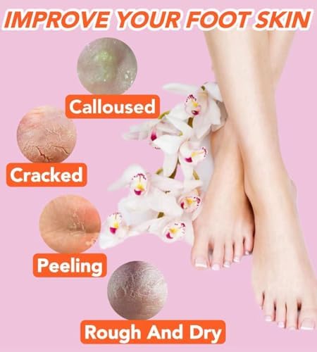 2 Pairs Silicone Socks for Dry Cracked Feet Women,Silicones Moisturizing Socks,Foot Spa Pedicure Silicone Socks for Repairing Dry Feet,Cracked Heels and Softening Rough Skin(Fits Size 8 to 11)