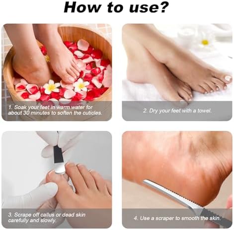 7 Pcs Professional Pedicure Tools for Feet, Stainless Steel Ingrown Toenail Removal Blade Kit with File, Toe Nail Knife Set for Men Women,Corn and Rasp Callus Remover Foot Scraper for Dead Skin
