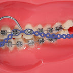 Colourful Elastic Power Chain for Braces Dental Orthodontic Powerchains 3 Sizes Ortho Rubber Band(Short,Purple 16#)