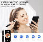 High-Definition Ear Wax Removal, Wireless Ear Cleaner, Safe and Gentle Ear Wax Removal Kit, Rechargeable Ear Cleaner with Camera and Light, Ear Cleaning Kit for Android and iOS (Black)