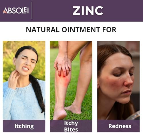Zinc Oxide Ointment, Natural Ointment for Itching and Rashes with Calendula and Plantain, 1.35 fl oz