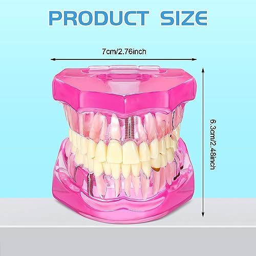 Outus Disease Teeth Model Dental Implant Teeth Model with Removable Tooth Dentist Standard Tooth Pathological Demonstration for Christmas Education Dental Supplies(Pink,1 Pcs)