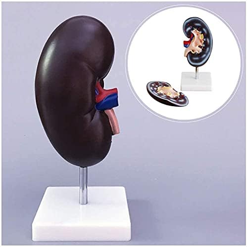Anatomy Model 2X Magnification Human Kidney Model - Medical Kidney Model Human Organ Model Detachable Kidney Structure Adrenal Gland for Study Teaching for Medic