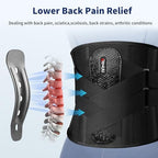 Lower Back Brace with 7X Bionic Support System for Women and Men, Adjustable Dual-X Back Support Belt Relief Lower Back Pain, Herniated Disc, Sciatica, Scoliosis, Breathable Mesh, Lumbar Support Belt with 3D Pad for Work, Black-L
