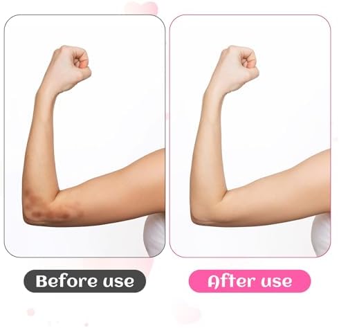 Piriuuo 2 Pairs/4 Pcs Elbow Moisturizing Sleeve, Elastic Gel Elbow Pads for Women, Soft Sleeve Elbows Protector for Spa Moisturizing Dry Cracked Skin Care (Pink)