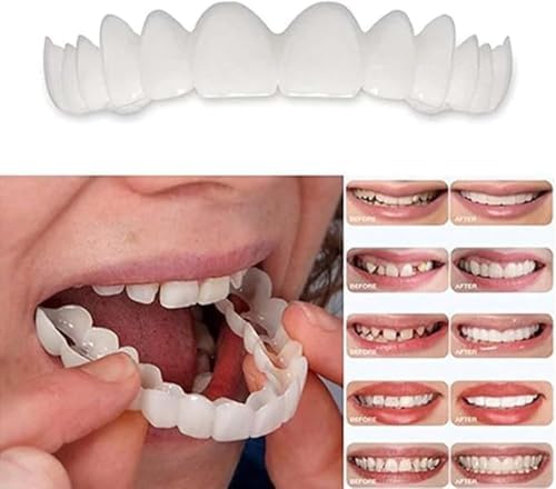 2 Pairs, Temporarily Restore Confident Smiling, Adjustable for Men and Women, Top and Bottom(1)