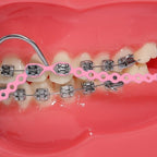 Colourful Elastic Power Chain for Braces Dental Orthodontic Powerchains 3 Sizes Ortho Rubber Band(Continuous,Pink 20#)