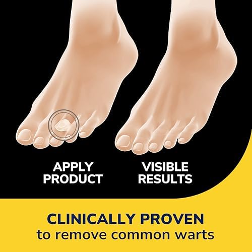 Dr. Scholl’s Clear Away Wart Remover Hydrogel Bandages for Fingers and Toes - Clinically Proven Effective Wart Removal and Cushioning Pain Relief, Comfortable Multi-Day Coverage Patches