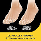 Dr. Scholl’s Clear Away Wart Remover Hydrogel Bandages for Fingers and Toes - Clinically Proven Effective Wart Removal and Cushioning Pain Relief, Comfortable Multi-Day Coverage Patches