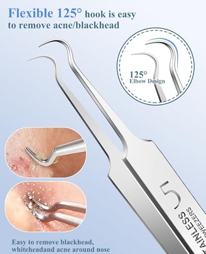 3PCS Blackhead Remover Tweezers, Pimple Popper Tool Kit with 2 Blackhead Extractor and 1 Ingrown Black Hair Tweezers for Blemish, Whitehead Popping,Facial Hair