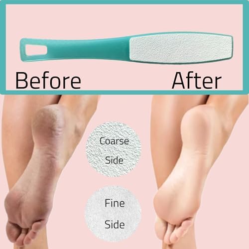 3 ALAZCO Double Sided Foot File Pumice Ergonomic Handle Scrubber Immediate Result Smooth Feet Heel Scraper Exfoliate Buffer Dead Skin Callus Corn Emery Fine & Coarse Pedicure Tool