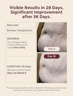 Momcozy Stretch Mark Cream for Pregnancy & Postpartum, Pro-Collagen Belly Firming Moisturizer, Facial-Grade Peptides & Oil-in-Cream, 5.29 oz (150g)
