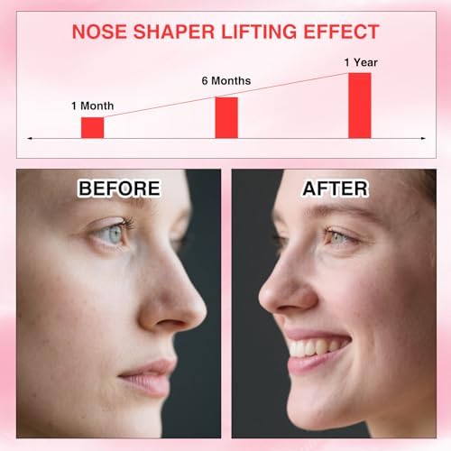 2 Pcs Nose Shaper Clip, Up Lifting Clip Nose Shaper, Silicone Wide Nose Slimmer Pain Free Up Lifting Straightener