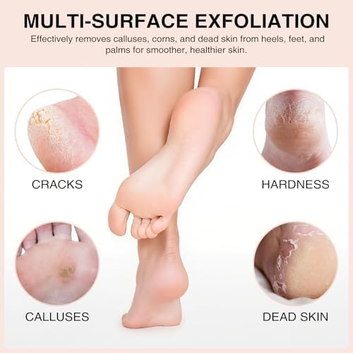 Natural Pumice Stone Set - 3-Pack Oval-Shaped Volcanic Lava Foot Scrubber Files for Callus, Corn, Cracked Heel, and Dead Skin Exfoliation, 4 x 2.8 x 1.6 Inches