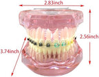 Dental Model, Orthodontic Typodont, Teeth Model Braces, Arch Wire, Metal Ceramic Bracket, Invisible Retainer, Single Buccal Tube, Ligature Ties, Teaching Practice Demonstration (M3012)