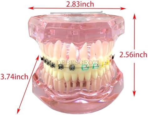 Dental Model, Orthodontic Typodont, Teeth Model Braces, Arch Wire, Metal Ceramic Bracket, Invisible Retainer, Single Buccal Tube, Ligature Ties, Teaching Practice Demonstration (M3012)