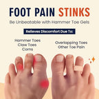 Dr. Frederick's Original Hammer Toe Corrector Gels - 2 Pairs - All-Day Relief for Crooked & Overlapping Toes - Soft Cushioning - Symptomatic Support for Toe Alignment - Beige - 1 Loop Design