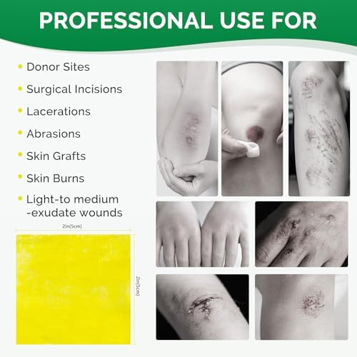 Xeroform Petrolatum Dressing 2inx2in 25 Individual Pack Wound Dressing, Non-Adherent Gauze Pads for Wounds, Partial Thickness Burns, Lacerations, Skin Grafts, Recipient Sites, Sutured Wounds
