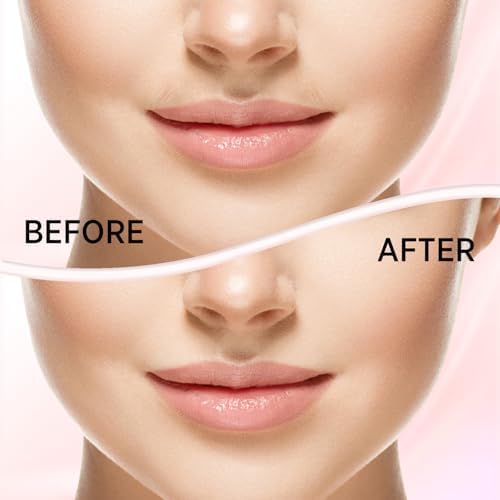 Facial Hair Removal for Women: Electric Face Razor with LED Light - Painless & Instant Results Mini Shaver for Travel Use (Rose Gold)