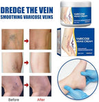 Varicose Veins Cream for Legs, Skin Cream for Legs, Moisturizing Leg Creams 50g/1.76fl.oz (2PCS)