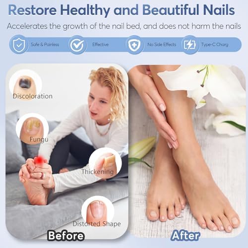 Nail Fungus Laser Treatment LED Light Device - At-Home Toenails & Fingernails Care, Rechargeable Light Treatment for Thick, Discolored Nails (Black)