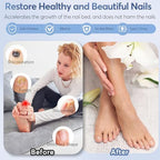 Nail Fungus Laser Treatment LED Light Device - At-Home Toenails & Fingernails Care, Rechargeable Light Treatment for Thick, Discolored Nails (Black)