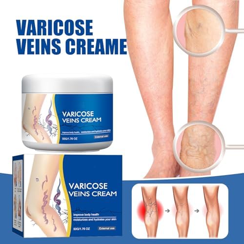 Varicose Veins Cream for Legs, Skin Cream for Legs, Moisturizing Leg Creams 50g/1.76fl.oz (2PCS)
