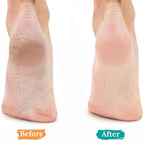2 Pcs Natural Pumice Stone for Feet Lava Foot Pumice Stones Foot Exfoliation Pedicure Dead Skin Scrubber Heels Callus Remover
