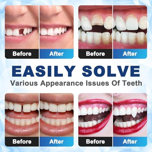 Tooth Repair Kit, Moldable False Teeth Beads for Teeth Repair-1PCS