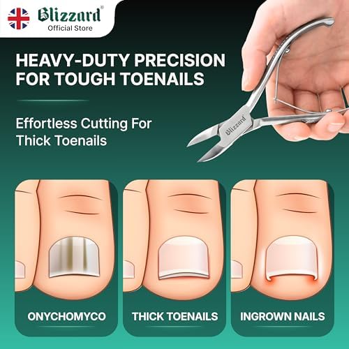 Nail Clippers for Men with Thick or Ingrown Toenails – Blizzard Podiatrist Toenail Clipper Set German Forged – 5.5 inch Heavy Duty Nail Cutter – Concave Head Chequered Handles - Hospital Grade