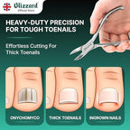 Nail Clippers for Men with Thick or Ingrown Toenails – Blizzard Podiatrist Toenail Clipper Set German Forged – 5.5 inch Heavy Duty Nail Cutter – Concave Head Chequered Handles - Hospital Grade