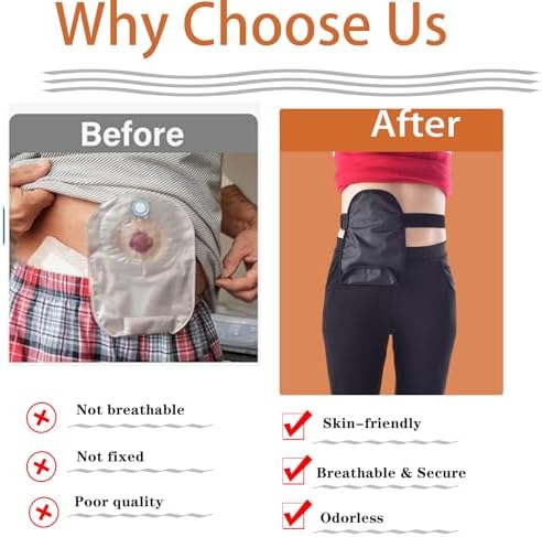 Ostomy Bag Covers Ostomy Belt Stealth Belt Ostomy Bag Cover Adjustable Ostomy Support Belts for Women Men Stoma Urostomy Ileostomy Recover
